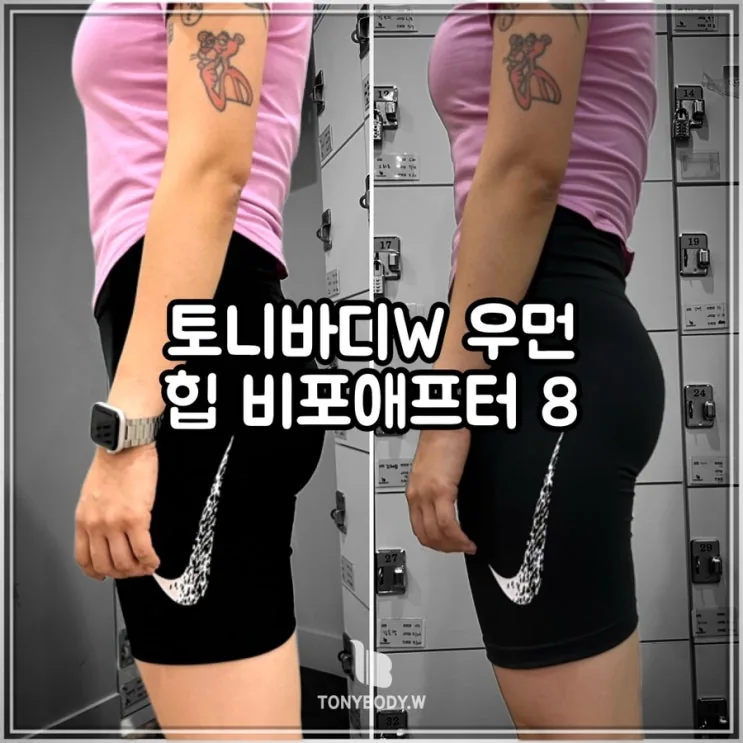 힙 비포애프터 8탄